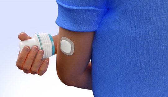 FDA Approves Medtronic's Simplera™ CGM 