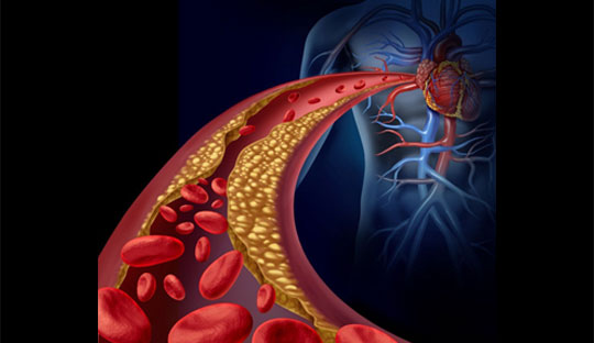 CSI clinical practice guidelines for dyslipidemia management 