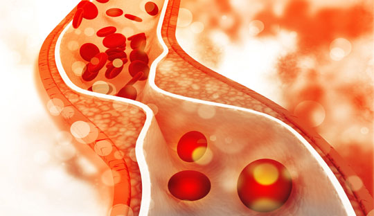 Understanding the Link Between HDL-C Levels and Diabetic Kidney Disease Risk