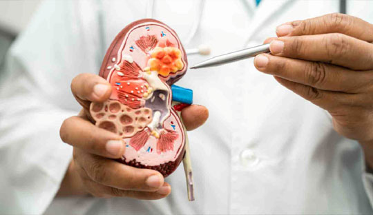 Semaglutide shows promising leap in reducing major kidney disease events –The FLOW trial