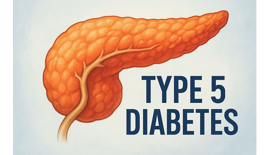 Malnutrition-Linked Diabetes Gets a Name: Introducing Type 5
