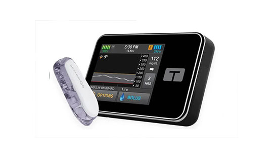 Control-IQ+ AID Technology Shows Positive Outcomes in Type 2 Diabetes
