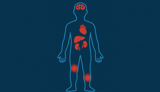 Targeting Inflammation